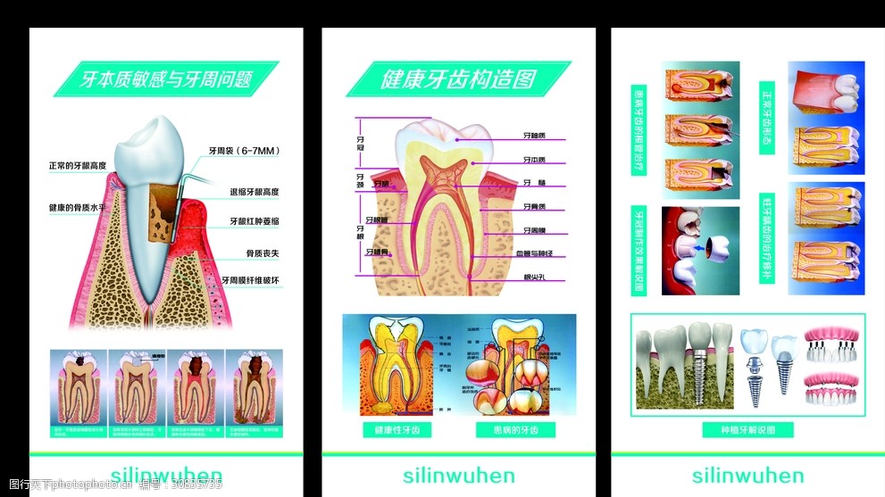 牙齿构造图