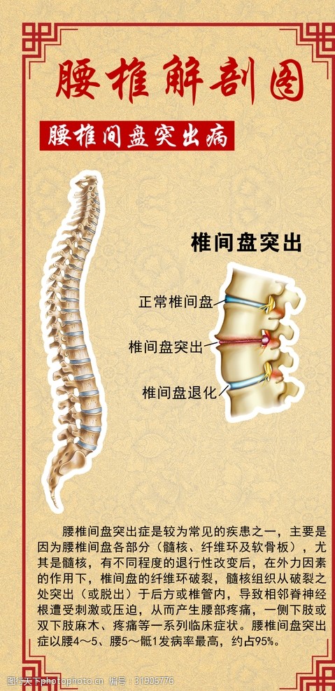 关键词:腰椎解剖图 腰椎 医院挂图 腰椎病 腰椎间盘突出 设计 广告